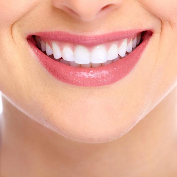 Teeth Bonding: What to Expect